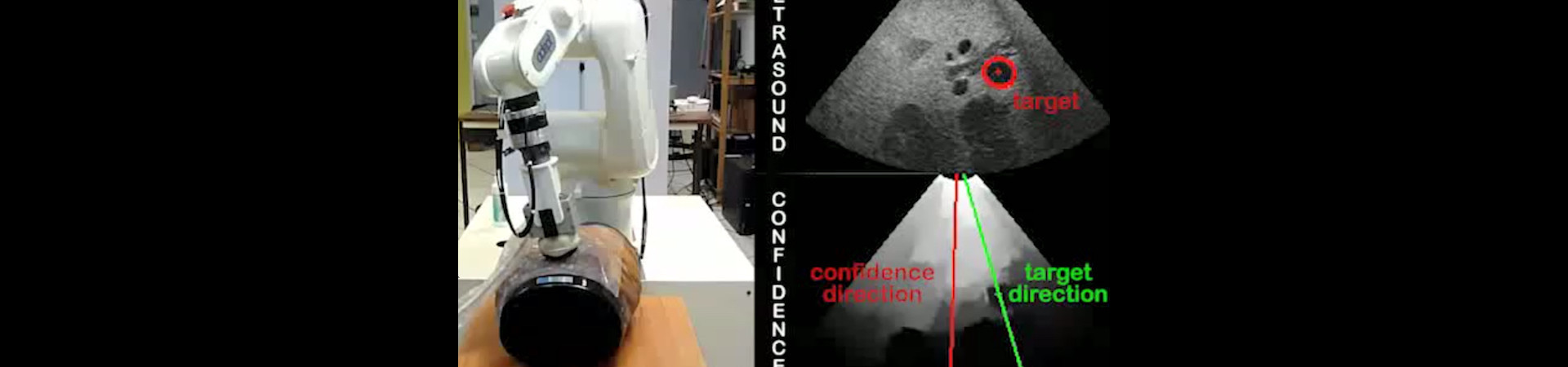 Automatic ultrasound image quality optimisation using confidence map